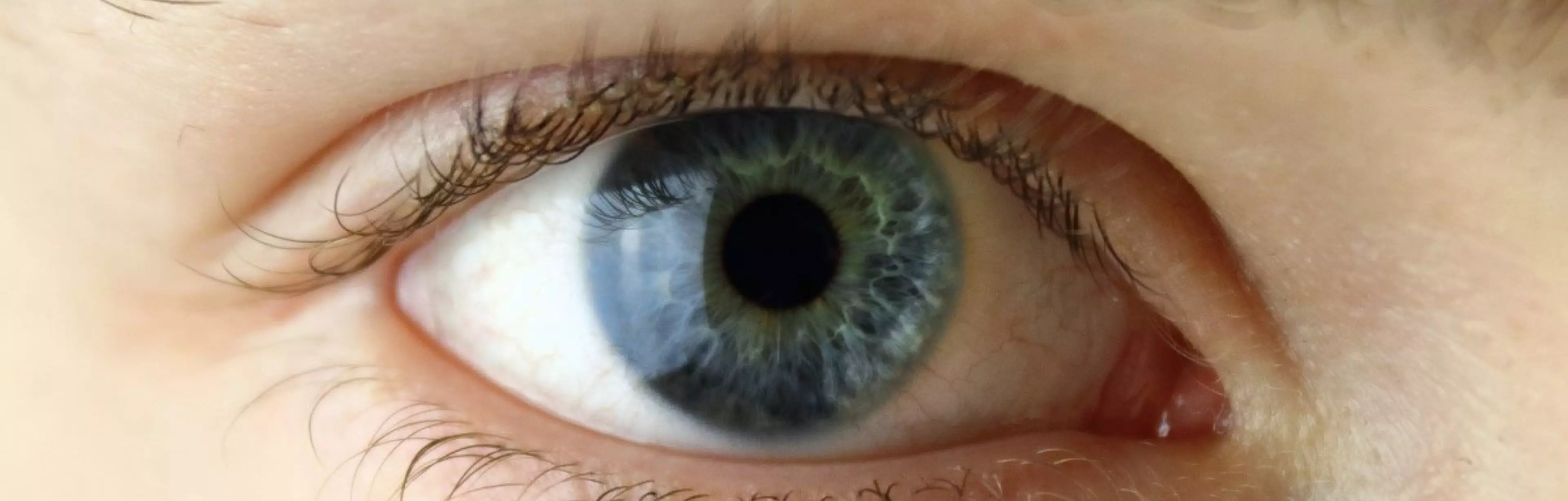 Consulta de Iridiologia